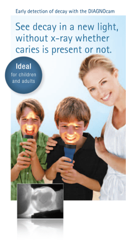 See decay in a new light, without x-ray whether caries is