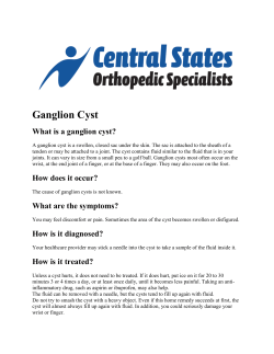 Ganglion Cyst - Glaser Sports Medicine
