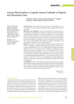 Access Recirculation in Jugular Venous Catheter in Regular and