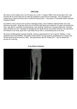 John`s leg My name is John Watson and I am 50 years old, on the 11