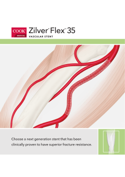 Choose a next generation stent that has been