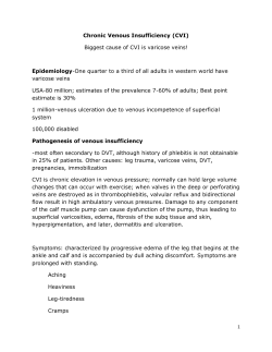 Chronic Venous Insufficiency (CVI) Biggest cause of CVI is varicose