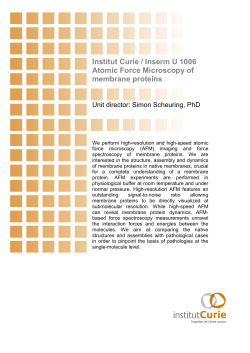 Institut Curie / Inserm U 1006 Atomic Force Microscopy of membrane