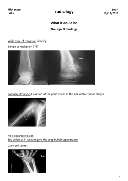 Bone metastases with sun burst periosteal reactions
