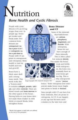 Bone Health and CF - University of Rochester Medical Center