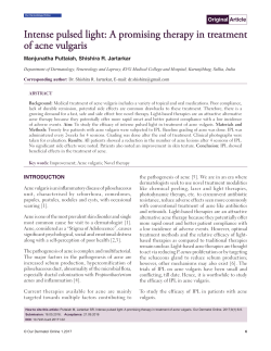 Intense pulsed light: A promising therapy in treatment of acne vulgaris