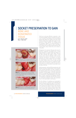 socket preservation to gain