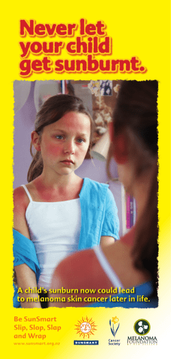 Never let your child get sunburnt.