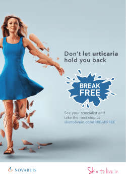 Don`t let urticaria hold you back