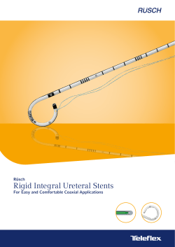 Rigid Integral Ureteral Stents