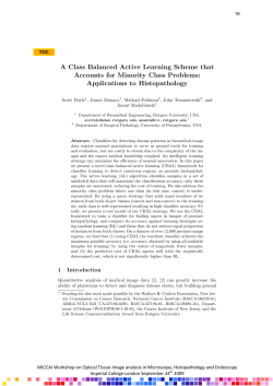 A Class Balanced Active Learning Scheme that Accounts for