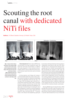 Scouting the root canal with dedicated NiTi files