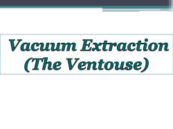 DOWNLOAD VACUUM EXTRACTION ppt