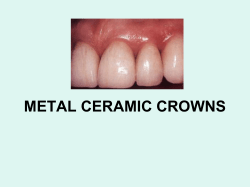 metal ceramic restoration