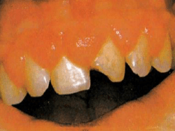 Q2-How you investigate this patient?