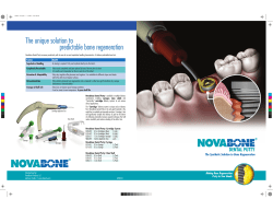 The unique solution to predictable bone regeneration