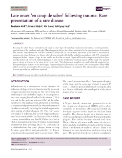 Late onset `en coup de sabre` following trauma: Rare presentation of