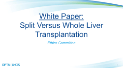 Ethics - Split Versus Whole Liver Transplantation