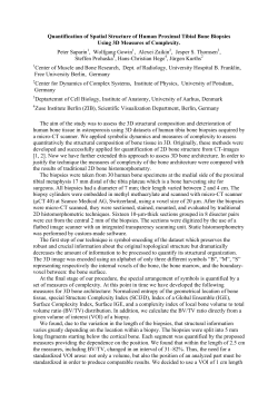 Quantification of Spatial Structure of Human Proximal Tibial Bone