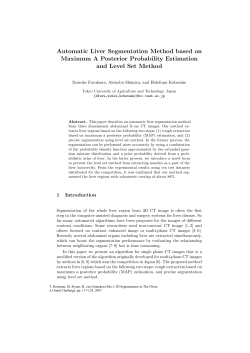 Automatic Liver Segmentation Method based on Maximum A