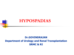 hypospadias
