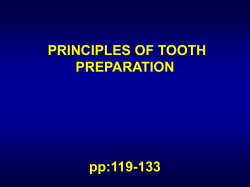 PRINCIPLES OF TOOTH PREPARATION