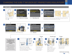 changing the sure-t&reg; infusion set: minimed&reg; 630g insulin pump