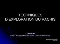 TECHNIQUES D`EXPLORATION DU RACHIS LOMBAIRE