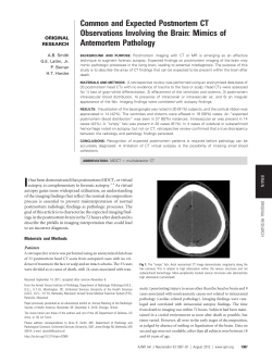 Common and Expected Postmortem CT Observations Involving the