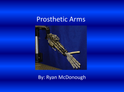 Prosthetic Arms - Department of Electrical, Computer and