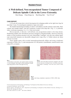 A Well-defined, Non-encapsulated Tumor Composed of Delicate
