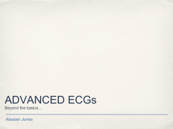 ADVANCED ECGs
