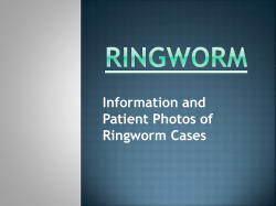 Ringworm - Montoursville Area School District