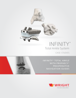 infinity