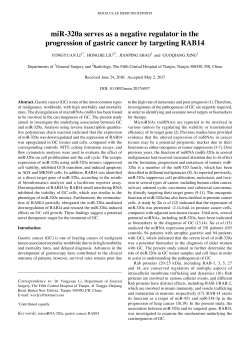 miR-320a serves as a negative regulator in the progression of