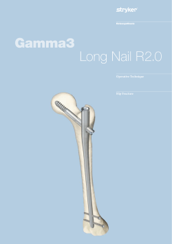 Gamma3 Long Nail R2.0