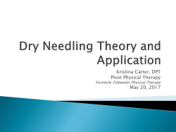 Theory and Benefit of Trigger Point Dry Needling