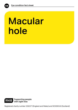 Macular hole factsheet