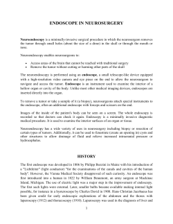 PRINCIPLE- based on Relay Lens System
