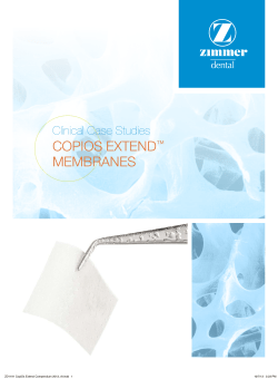 copios extend&trade; membranes