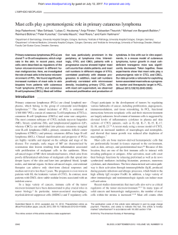 Mast cells play a protumorigenic role in primary