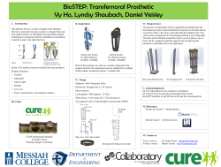 BioSTEP: Transfemoral Prosthetic
