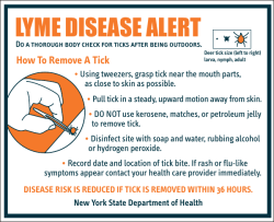 Lyme Disease Alert: How To Remove A Tick