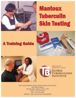 Mantoux Tuberculin Skin Testing: A Training Guide