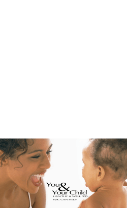 Printable version of this information (Brochure)