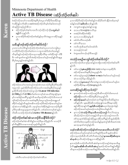 Active TB Disease - Karen (PDF: 260KB/2 pages)