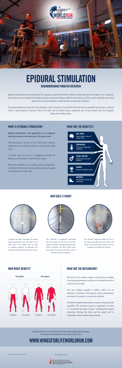 epidural stimulation