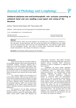 Unilateral subclavian vein and brachiocephalic vein occlusion