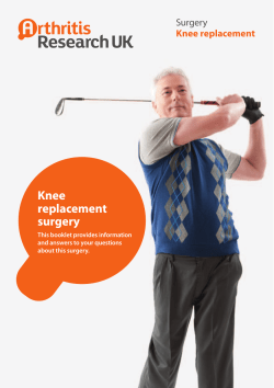 Knee replacement Knee replacement surgery