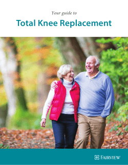 Total Knee Replacement